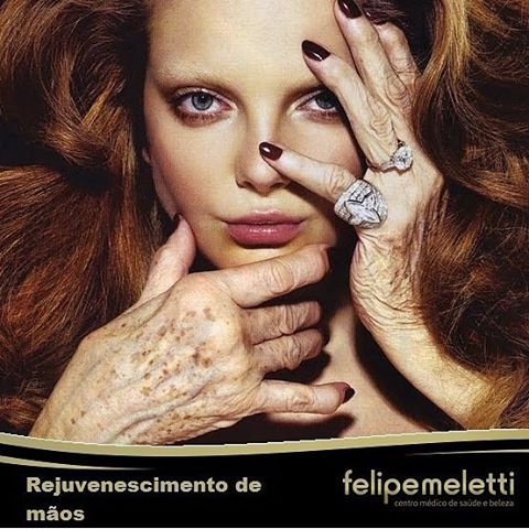 Rejuvenescimento de mãos
