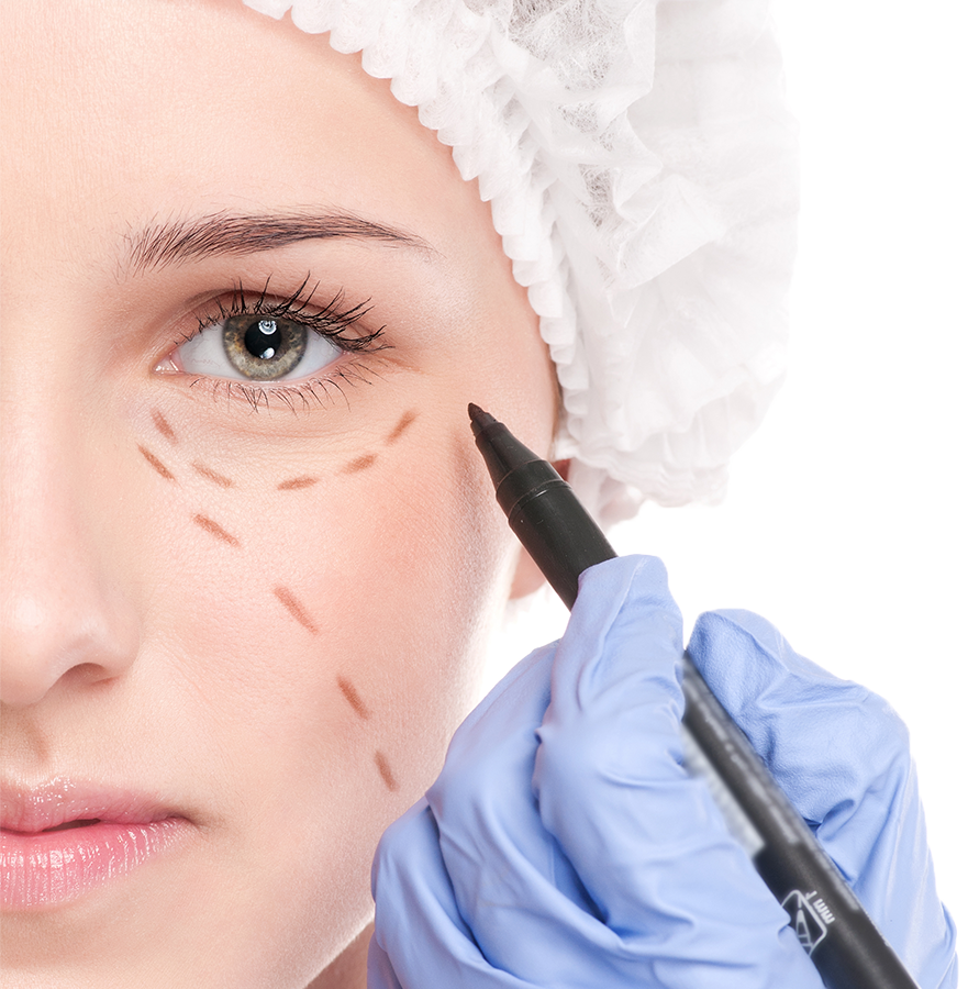 Peeling de Fenol Profundo - Clínica Felipe Meletti - Restart Facial Peeling de Fenol Profundo - Clínica Felipe Meletti - Restart Facial