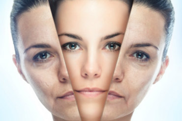 Laser de CO2 Fracionado tratamento facial