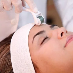 microagulhamento facial