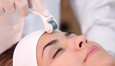 microagulhamento facial