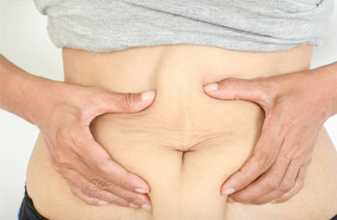 tratamento celulite barriga