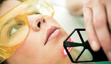 tratamento laser co2 pescoco colo